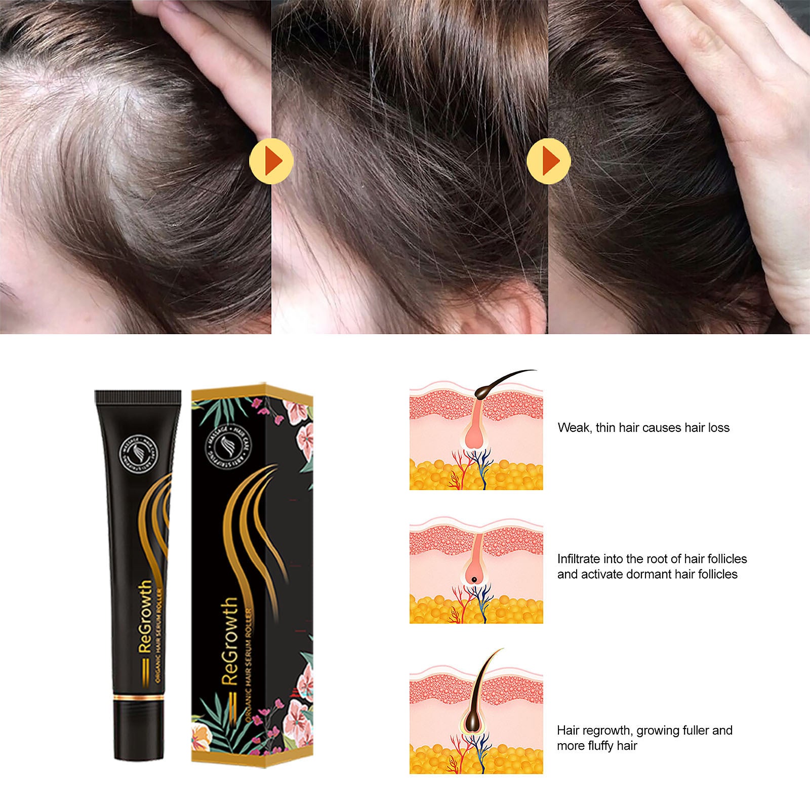 Regrowth Hair Serum Set